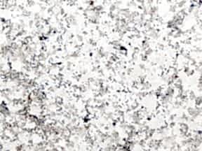 Biancosardoindia | Granit Tezgah Ankara