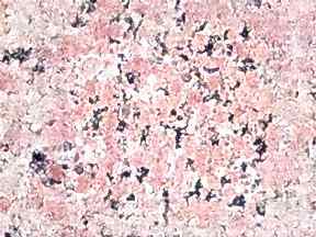 Rosypinkindia Granit | Mutfak Tezgahi Fiyatlari Ankara