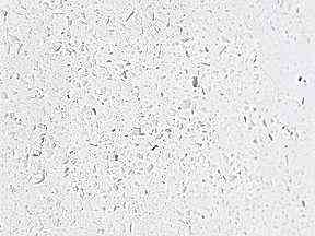 Kristellaw1 8844a | Granit Tezgah Modelleri Ankara